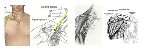 Neuropathy Of The Suprascapular Nerve Dr Besiris