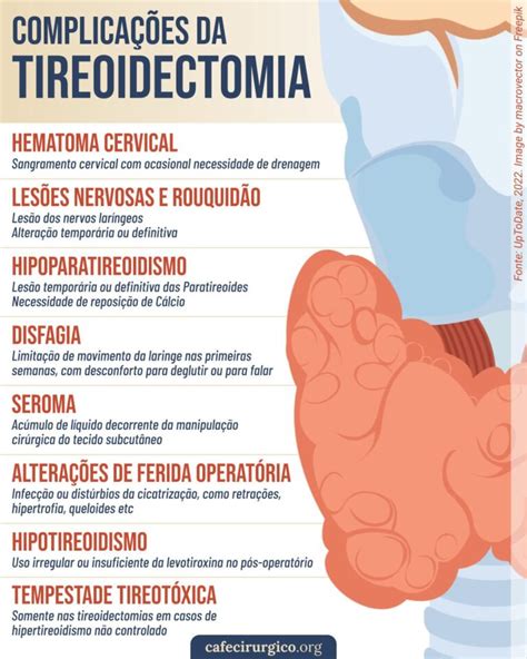 Complica Es Da Tireoidectomia O Que Pode Dar Errado Na Cirurgia De