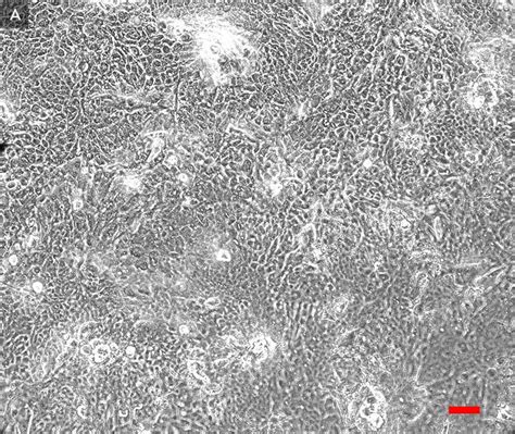 ATCC Human Bronchial Tracheal Epithelial Cells ATCC