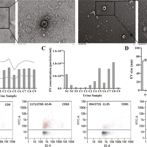 The Characterization Of Evs Isolated From Urine A Representative Tem