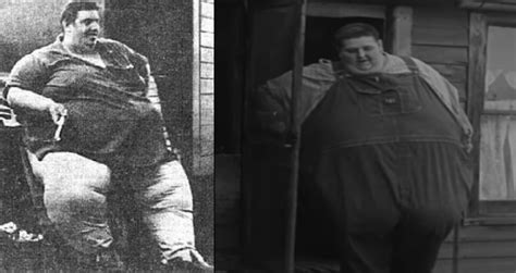 Meet the Heaviest Human Ever Recorded in Medical History