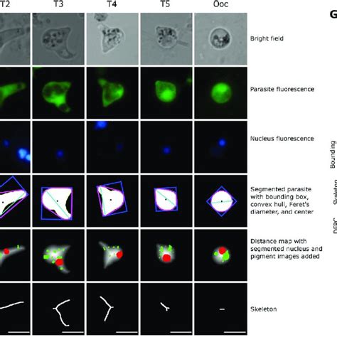 Normal Progression Of The Differentiation Process And Aberrant Forms In