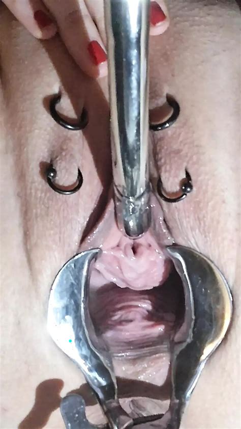 Free Speculum Porn Videos XHamster