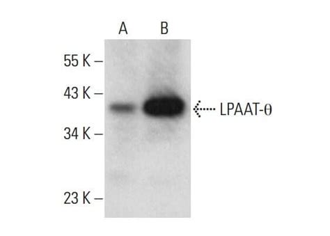 Lpaat θ Antibody F 7 Scbt Santa Cruz Biotechnology