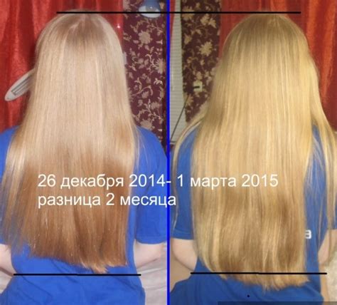 Перфектил Трихолоджик. Инструкция по применению, состав витаминов для ...