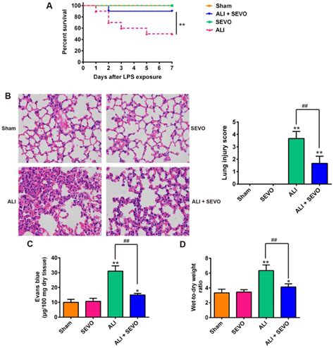 Sevoflurane Alleviates Lpsinduced Acute Lung Injury Via The Microrna