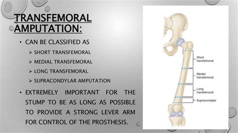 Lower limb amputation