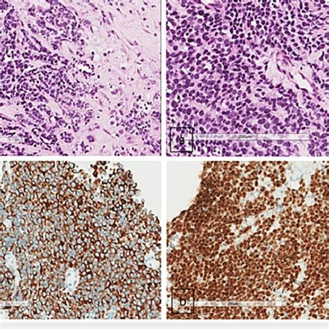 Histopathology Examination With Hematoxylin And Eosin Hande Stains And Download Scientific