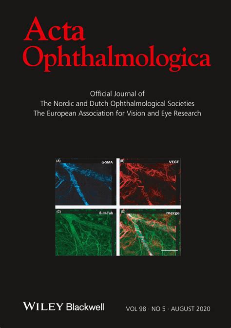 Association Of Sex With The Global Burden Of Glaucoma An Analysis From