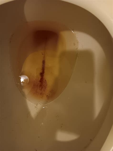 I've been feeling weak, achy, chilly, and unreal for awhile and idk but