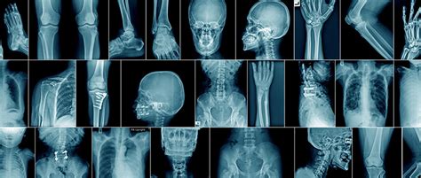 orthopedic surgery school  medicine columbia university  south