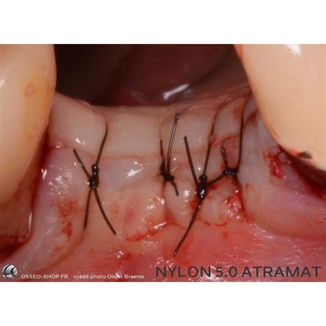 Sutures Dentaire Nylon Atramat Bo Te De Fils Ttc Non