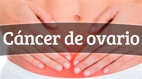 Cáncer de ovario Síntomas y tratamiento YouTube