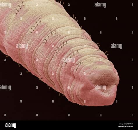 Tubifex Worm Coloured Scanning Electron Micrograph Sem Tubifex Tubifex Also Called The