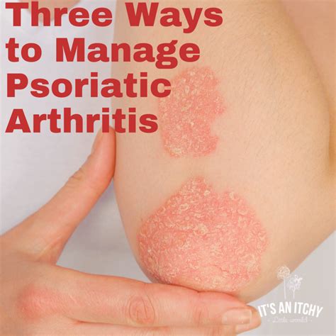 Three Ways to Manage Psoriatic Arthritis