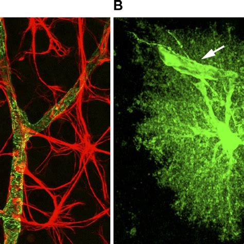 Reactive Astrocytes Show Hypertrophy Of Their Cellular Processes But