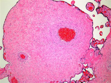 Human Mesenchymal Stem Cells