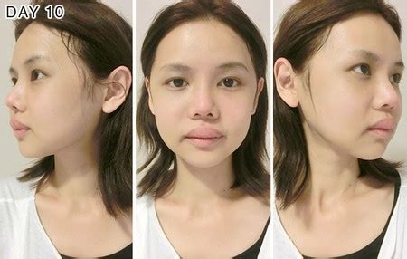 Hot girl Singapore bị chỉ trích vì ham phẫu thuật thẩm mỹ