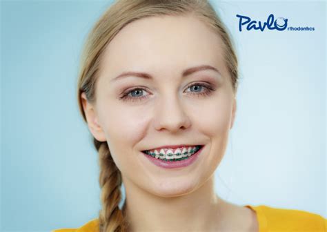 Can I Have Braces If I Have Missing Teeth?- Pavlo Orthodontics