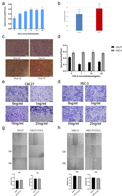 The Effect Of CCL2 On Lnmtca8113 Cal27 And HSC 3 Cell Migration