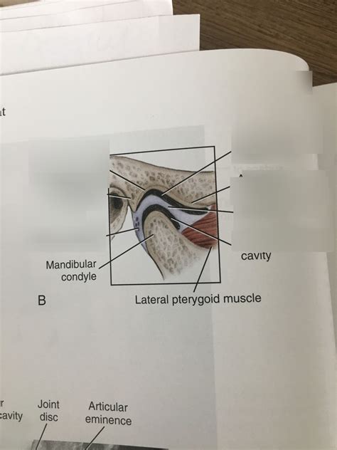 TMJ Diagram | Quizlet