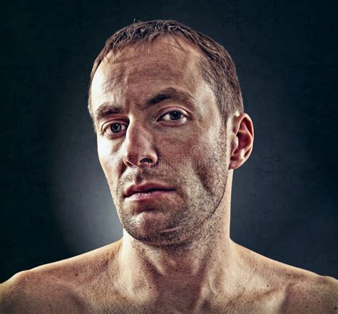 men skin problems stock photo image  blackheads blister