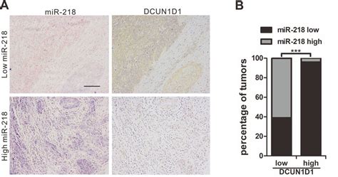 Clinical Associations Of Mir With Dcun D Expression A