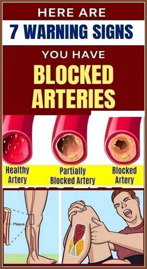 how to know if you have a blocked artery