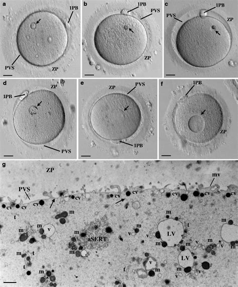 Live Human Mature Oocytes Observed At The Inverted Microscope A The