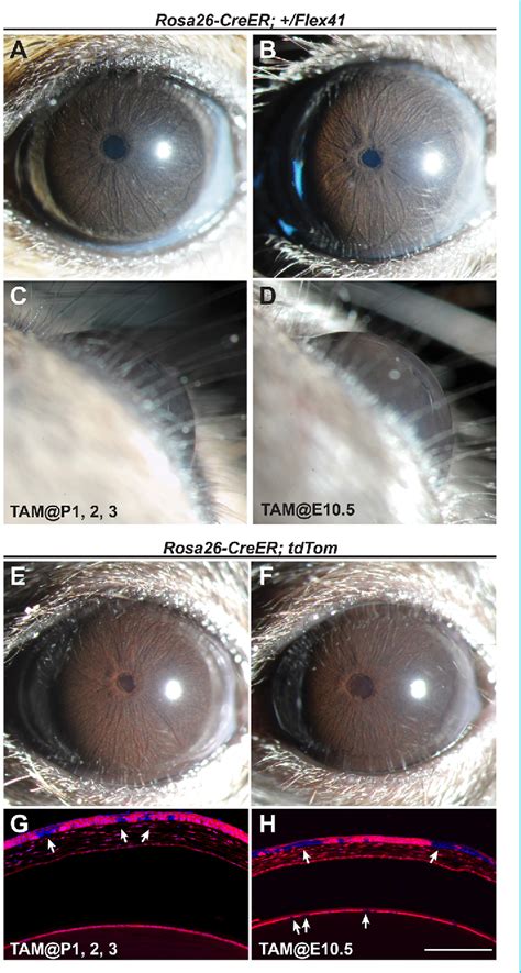 Figure From Genetic Dissection Of Anterior Segment Dysgenesis Caused