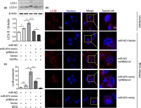 Circtrappc6b Regulated Autophagy In Mtb‐infected Macrophages Via