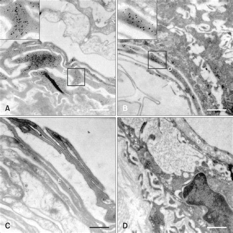 A Transmission Electron Micrograph Of The Sprague Dawley Albino Rat