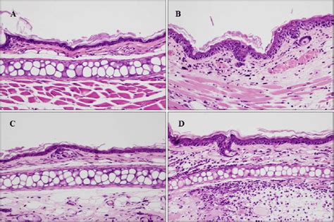 Both Retinol And Benzalkonium Chloride Bkc Induced Epidermal