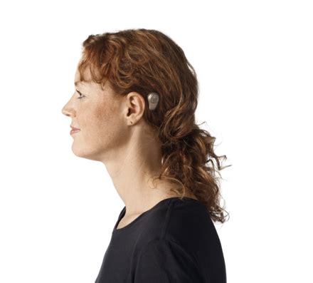 bone anchored hearing aid wikipedia