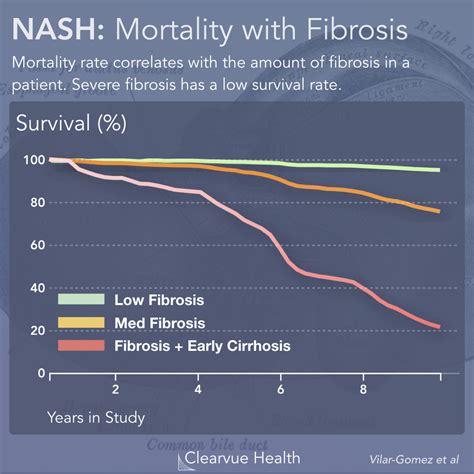 Nash Liver Disease Stages