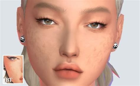 Sims 4 Scars CC 29 Body Acne And More Scar Mods In 2024 Sims 4 Cc