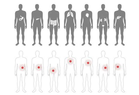 Understanding Small Fiber Neuropathy: Symptoms, Causes, and Treatments ...