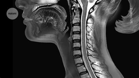 Unveiling The Comprehensive Spinal Cord Atlas A Key To Understanding