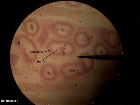 PSC: Anatomy and Physiology 2: Epididymis Slide