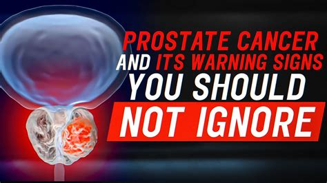 Prostate Cancer Symptoms Warning Signs Of Prostate Cancer You Should