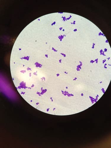 Lab Bacterial Cells Simple Negative Staining Flashcards Quizlet