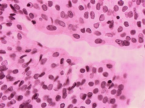 Transitional Epithelium 40x Histology