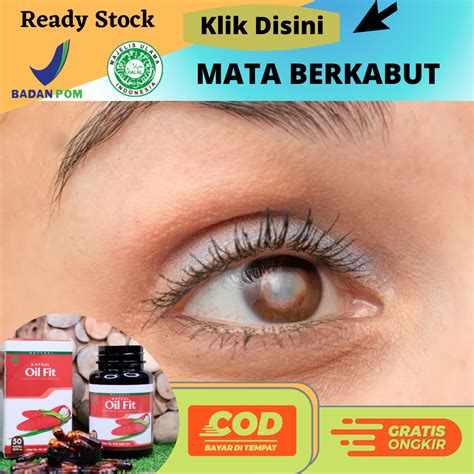 Obat Mata Floaters Dan Berkabut Penglihatan Seperti Berkabut Berasap