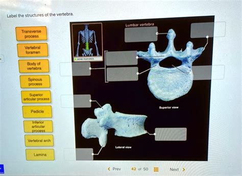 Solved Label The Structures Of The Vertebrae Lumbar Vertebrae