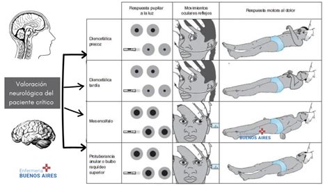 Valoración neurológica del paciente crítico 2024