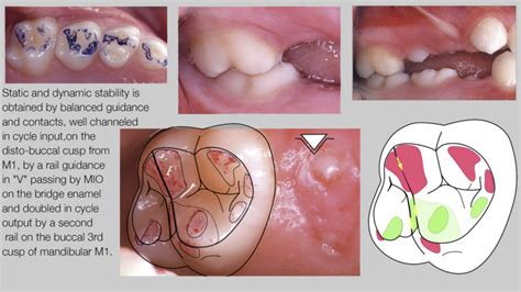 human canine teeth function