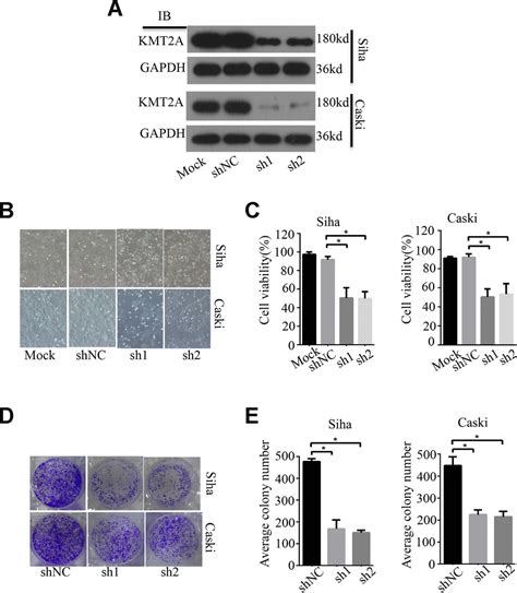 Kmt A Regulates Cervical Cancer Cell Growth Through Targeting Vdac