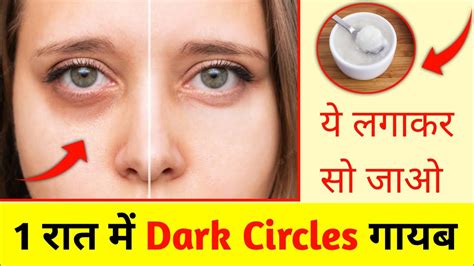 Dark Circles Kaise Hataye 1 ही रात मे आंखो के काले घेरे हटाए घरेलू