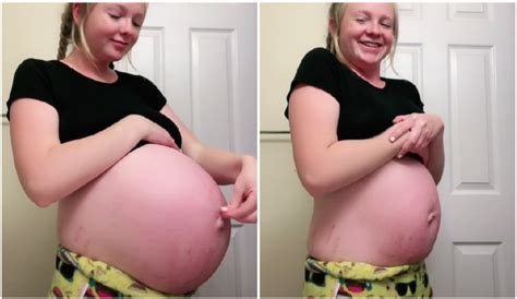 Grávida esvazia barriga em vídeo viral e técnica gera dúvida se é segura