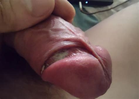 Cock Cheese Nude Pics Xhamster